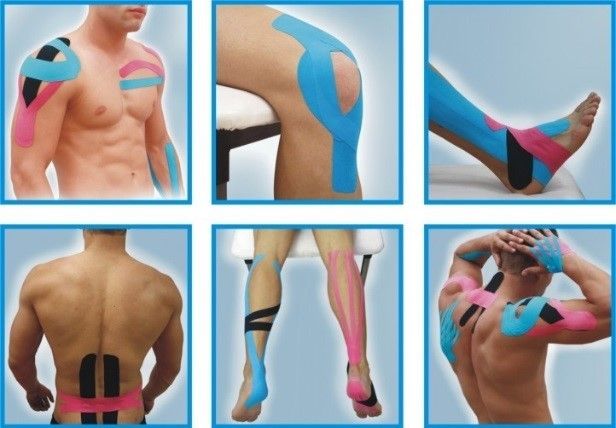 Kinesio Taping